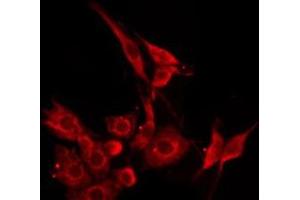 ABIN6276235 staining HepG2 by IF/ICC. (VIPR2 抗体  (Internal Region))