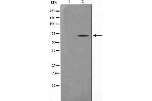 Western Blotting (WB) image for anti-Nuclear Receptor Subfamily 4, Group A, Member 3 (NR4A3) antibody (ABIN6263724)