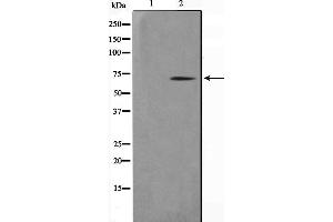 Western blot analysis on COLO205 cell lysate using NR4A3 Antibody,The lane on the left is treated with the antigen-specific peptide. (NR4A3 抗体)