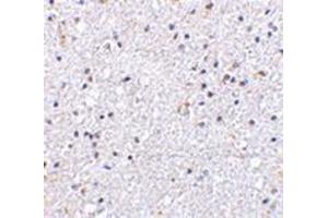 Immunohistochemistry of VISA in human brain tissue with this product at 5 μg/ml. (MAVS 抗体  (N-Term))
