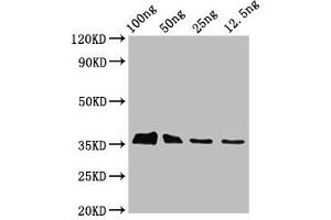 anti-Epstein-Barr Virus BLLF3 (AA 1-278) antibody
