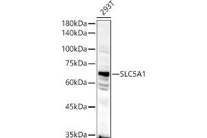 Western Blotting (WB) image for anti-Solute Carrier Family 5 (Sodium/glucose Cotransporter), Member 1 (SLC5A1) (AA 350-450) antibody (ABIN6148019)