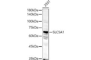 Western blot analysis of extracts of 293T cells, using SLC5 antibody (1976) at 1:500 dilution. (SLC5A1 抗体  (AA 350-450))
