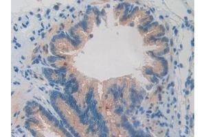 Detection of BMP15 in Rat Lung Tissue using Polyclonal Antibody to Bone Morphogenetic Protein 15 (BMP15) (BMP15 抗体  (AA 269-391))