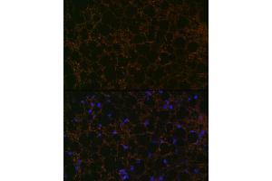 Immunofluorescence analysis of rat fat using Perilipin A Rabbit mAb (ABIN7269218) at dilution of 1:100 (40x lens).