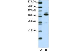WB Suggested Anti-TADA3L Antibody Titration:  0. (TADA3L 抗体  (C-Term))