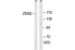Western blot analysis of extracts from Jurkat cells, using ZEB2 Antibody. (ZEB2 抗体  (AA 71-120))