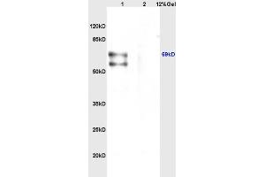 Lane 1: mouse brain lysates Lane 2: mouse heart lysates probed with Anti CHRNA4 Polyclonal Antibody, Unconjugated (ABIN736746) at 1:200 in 4 °C. (CHRNA4 抗体  (AA 531-627))