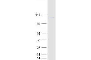 Validation with Western Blot