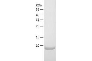 Chemokine (C Motif) Ligand 2 (XCL2) (AA 22-114) protein (His-IF2DI Tag)