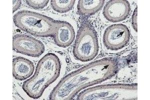 Immunohistochemistry (IHC) image for anti-Transient Receptor Potential Cation Channel, Subfamily M, Member 5 (TRPM5) (AA 32-45), (Intracellular) antibody (ABIN7043834)