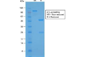 SDS-PAGE Analysis Purified TTF-1 Rabbit Recombinant Monoclonal Antibody (NX2. (Recombinant NKX2-1 抗体)