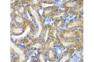 Immunohistochemistry of paraffin-embedded Rat kidney using FAH Polyclonal Antibody at dilution of 1:100 (40x lens).