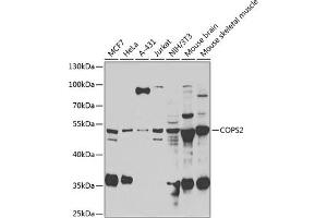 Western blot analysis of extracts of various cell lines, using COPS2 antibody (ABIN6130123, ABIN6138877, ABIN6138878 and ABIN6222819) at 1:1000 dilution. (COPS2 抗体  (AA 1-310))