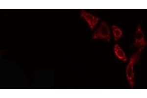 ABIN6276596 staining NIH-3T3 cells by IF/ICC. (PDGFB 抗体  (N-Term))