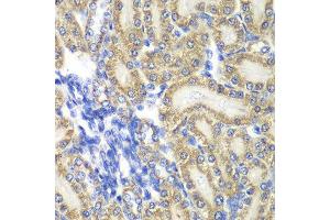 Immunohistochemistry of paraffin-embedded rat kidney using PTGES2 antibody at dilution of 1:100 (x40 lens). (PTGES2 抗体)