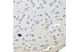 Immunohistochemistry of paraffin-embedded mouse brain using CHRNB2 antibody (ABIN6003540) at dilution of 1/100 (40x lens). (CHRNB2 抗体)