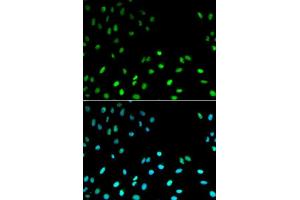 Immunofluorescence analysis of MCF-7 cells using RFC1 antibody.