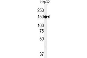 Western Blotting (WB) image for anti-ATP-Binding Cassette, Sub-Family C (CFTR/MRP), Member 10 (ABCC10) (AA 774-801), (Middle Region) antibody (ABIN950199)