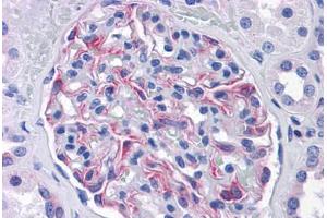 Human Kidney: Formalin-Fixed, Paraffin-Embedded (FFPE) (SLC44A2 抗体  (AA 123-231))