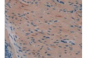 IHC-P analysis of Rat Stomach Tissue, with DAB staining. (HAO1 抗体  (AA 102-357))