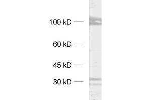 dilution: 1 : 1000, sample: synaptic membrane fraction (LP1) (Kv2.1/KCNB1 抗体  (AA 532-857))