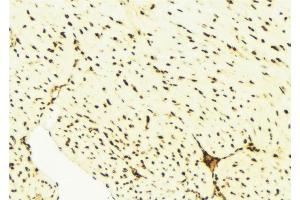 ABIN6276514 at 1/100 staining Mouse liver tissue by IHC-P. (BAG1 抗体  (N-Term))