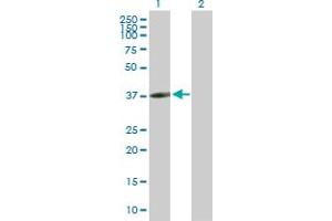 Western Blot analysis of CLEC10A expression in transfected 293T cell line by CLEC10A MaxPab polyclonal antibody. (CLEC10A 抗体  (AA 1-316))