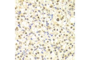 Immunohistochemistry (IHC) image for anti-Damage-Specific DNA Binding Protein 2, 48kDa (DDB2) (AA 1-315) antibody (ABIN3022632) (DDB2 抗体  (AA 1-315))