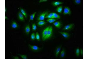 Immunofluorescence staining of A549 cells with ABIN7147205 at 1:133, counter-stained with DAPI. (CD99L2 抗体  (AA 26-145))