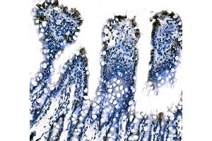 anti-Splicing Factor 1 (SF1) (AA 160-266) antibody