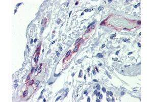 EHD4 antibody was used for immunohistochemistry at a concentration of 4-8 ug/ml. (EHD4 抗体  (Middle Region))