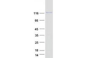 Western Blotting (WB) image for Oxysterol Binding Protein 2 (OSBP2) (Transcript Variant 1) protein (Myc-DYKDDDDK Tag) (ABIN2727974)