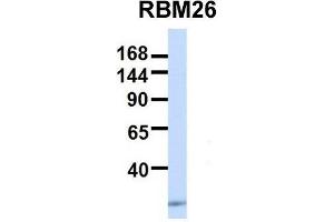 Host:  Rabbit  Target Name:  RBM26  Sample Type:  Human 293T  Antibody Dilution:  1. (RBM26 抗体  (Middle Region))