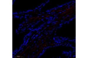 Immunofluorescence of paraffin embedded human prostate using paldadin (ABIN7074976) at dilution of 1: 500 (300x lens) (PALLD 抗体)