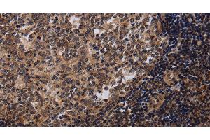 Immunohistochemistry of paraffin-embedded Human tonsil tissue using NTMT1 Polyclonal Antibody at dilution 1:40 (METTL11A 抗体)