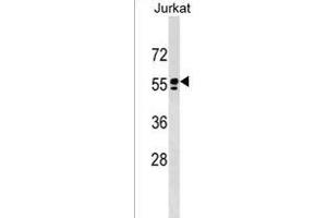 Western Blotting (WB) image for anti-Sperm Adhesion Molecule 1 (PH-20 Hyaluronidase, Zona Pellucida Binding) (SPAM1) (AA 429-457), (C-Term) antibody (ABIN1537320)