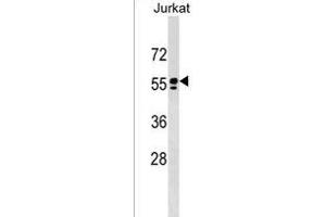SM1 Antibody (C-term)  western blot analysis in Jurkat cell line lysates (35 μg/lane). (SPAM1 抗体  (C-Term))