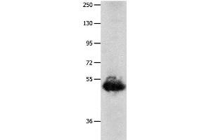 Western Blot analysis of Human lung cancer tissue using BPIFB3 Polyclonal Antibody at dilution of 1:1600 (BPIFB3 抗体)