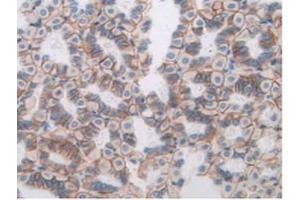 IHC-P analysis of Mouse Stomach Tissue, with DAB staining. (ANGPTL3 抗体  (AA 22-281))