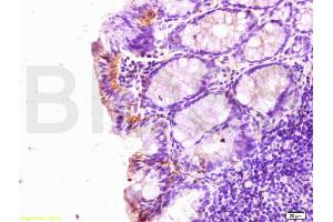 Formalin-fixed and paraffin embedded rat colitis labeled with Rabbit Anti SLC40A1 Polyclonal Antibody, Unconjugated (ABIN701095) at 1:200 followed by conjugation to the secondary antibody and DAB staining (SLC40A1 抗体)