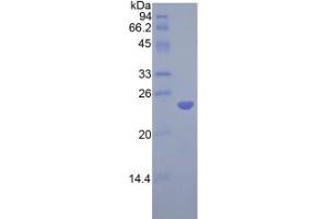 SDS-PAGE analysis of Rat COMT Protein. (COMT 蛋白)