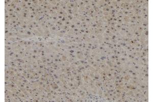 ABIN6272894 at 1/100 staining Mouse liver tissue by IHC-P. (PPP1R15B 抗体)