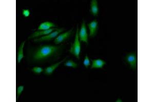 Immunofluorescence staining of Hela cells with ABIN7162684 at 1:200, counter-stained with DAPI. (PASK 抗体  (AA 482-602))