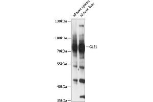 Western blot analysis of extracts of various cell lines, using GLE1 antibody (ABIN6131943, ABIN6141121, ABIN6141123 and ABIN6217118) at 1:3000 dilution. (GLE1 抗体  (AA 1-300))