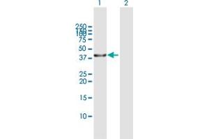 Western Blot analysis of SERPINB3 expression in transfected 293T cell line by SERPINB3 MaxPab polyclonal antibody. (SERPINB3 抗体  (AA 1-390))
