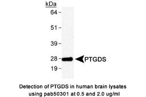 Image no. 1 for anti-Prostaglandin D2 Synthase (PTGDS) antibody (ABIN363610)
