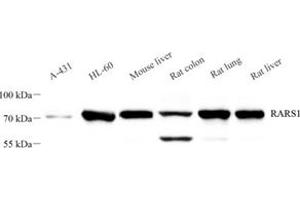Western blot analysis of RARS (ABIN7073119),at dilution of 1: 2000 (RARS 抗体)