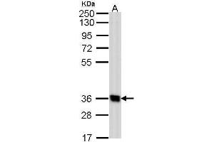 WB Image Sample (30 ug of whole cell lysate) A: Hep G2 , 10% SDS PAGE antibody diluted at 1:1000 (GPR62 抗体  (N-Term))