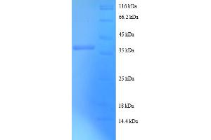 SDS-PAGE (SDS) image for Death-Associated Protein (DAP) (AA 2-102) protein (GST tag) (ABIN5712105) (DAP Protein (AA 2-102) (GST tag))